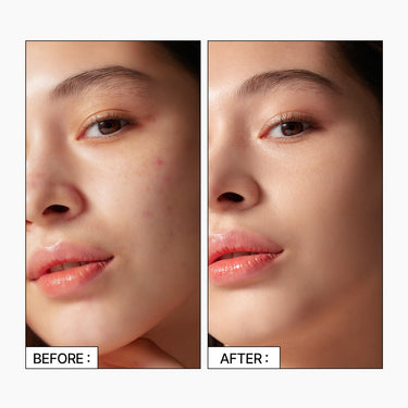 Parnell Cicamanu Skin Fit Cover Concealer 5g - CUTIPOP