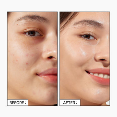 Parnell Cicamanu 92 serum 30ml - CUTIPOP